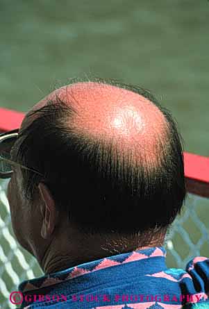 Stock Photo #4128: keywords - bald balding body color genetic hair head human loosing man person skin skull trait vert