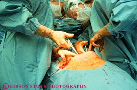 Stock Photo #5049: keywords -  birth birthing caesarean cut doctor doctors emergency horz hospital medical medicine motherhood procedure sterile surgeon surgery