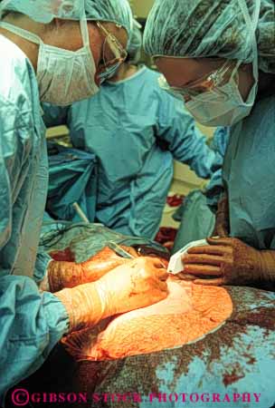 Stock Photo #5052: keywords -  birth birthing caesarean cut doctor doctors emergency hospital medical medicine motherhood procedure sterile surgeon surgery vert
